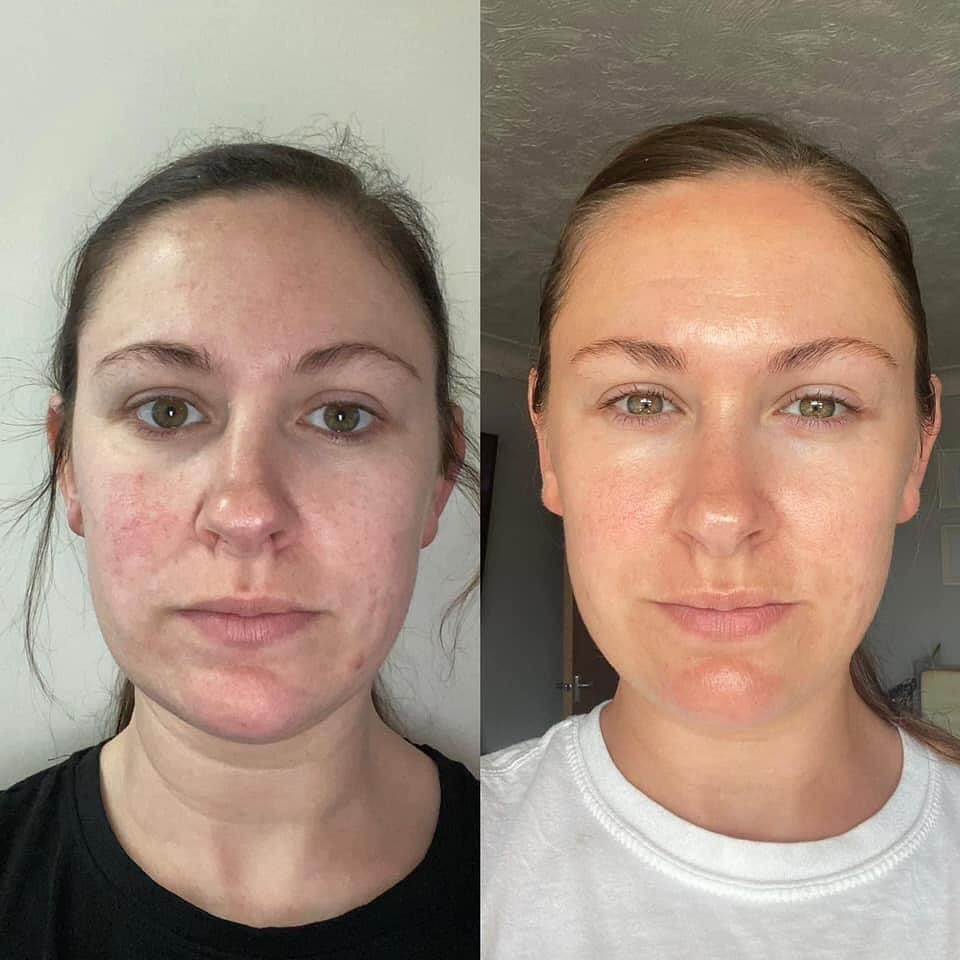 Collagen & Elastin Booster - Advanced Skin Regeneration